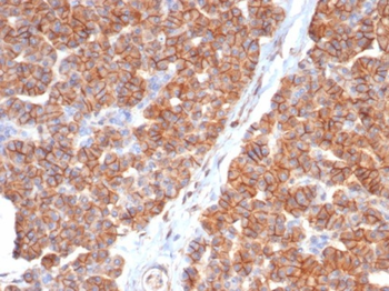 CD99 Antibody