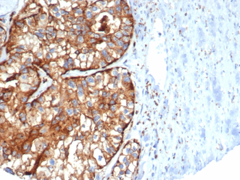 DPP4 Antibody