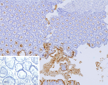 CEACAM5 Antibody