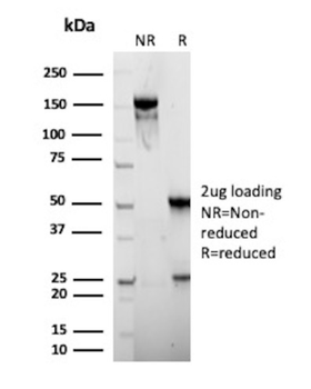 CEACAM5 Antibody