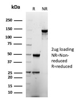 CEACAM5 Antibody