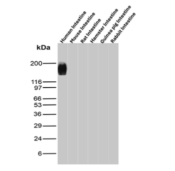 CEACAM5 Antibody