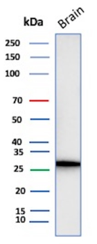 CALB2 Antibody