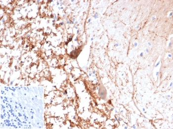 CALB2 Antibody