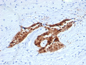 CALB2 Antibody