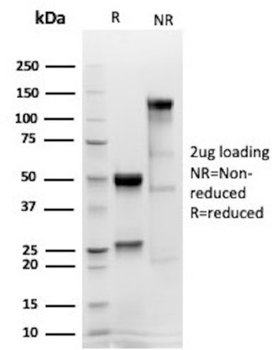 CALB2 Antibody