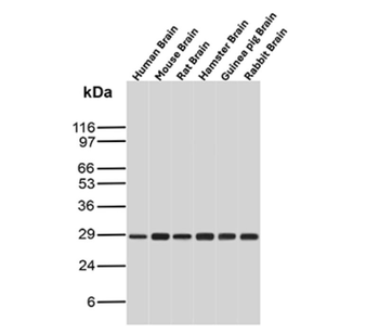 CALB2 Antibody