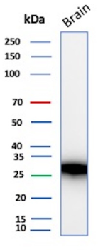 CALB1 Antibody