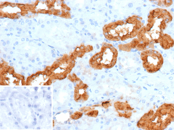 CALB1 Antibody