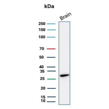 CALB1 Antibody