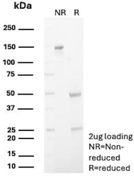 CALB1 Antibody