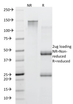 MUC5AC (Mucin 5AC / Gastric Mucin) Antibody