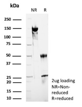HSD17B13 Antibody