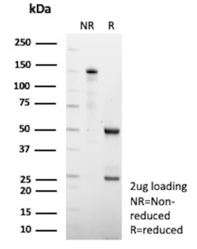 HSD17B13 Antibody