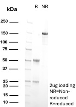 CYP2C9 Antibody