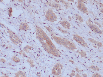 BAP1 Antibody