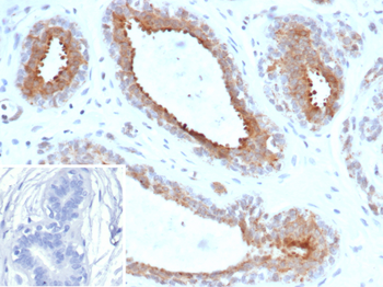 BAP1 Antibody