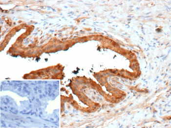 LGALS3 Antibody