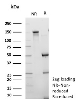 ENPP3 Antibody