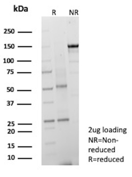 ENPP3 Antibody