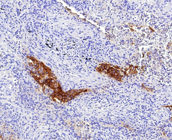 F3 Antibody