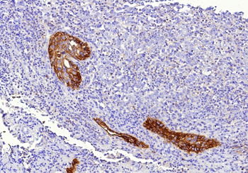 F3 Antibody