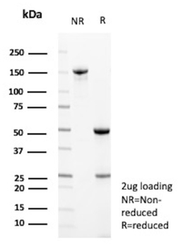 L1CAM Antibody