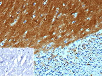 L1CAM Antibody