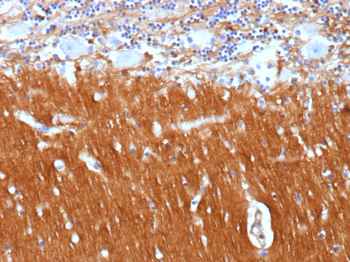 L1CAM Antibody
