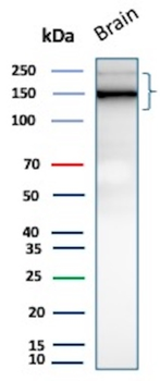 L1CAM Antibody