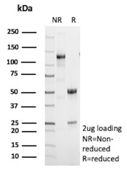 CETN1 Antibody