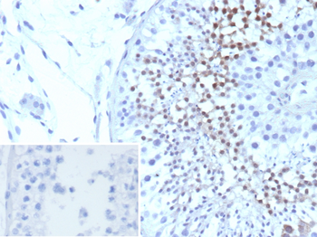 CETN1 Antibody