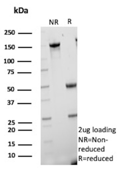 CETN1 Antibody