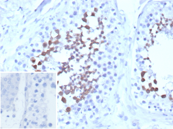 CETN1 Antibody