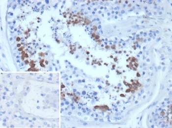CETN1 Antibody