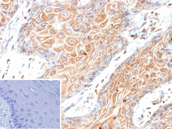 HBEGF Antibody