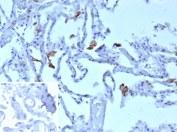 MRC1 Antibody