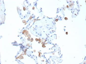MRC1 Antibody