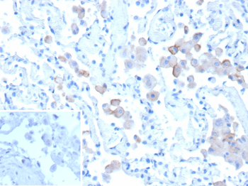 MRC1 Antibody