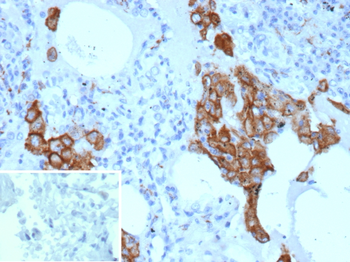 MRC1 Antibody