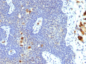 HPV-16 (Human Papilloma Virus 16) Antibody