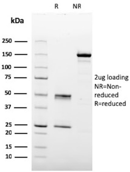 HPV-16 (Human Papilloma Virus 16) Antibody