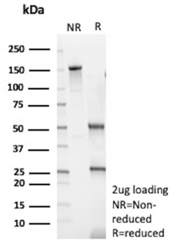 MYH7 Antibody