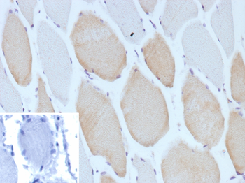 MYH7 Antibody