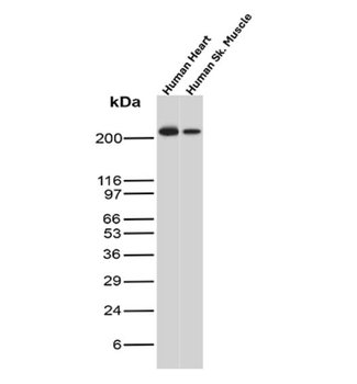 MYH7 Antibody