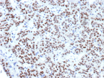 NKX2-1 Antibody