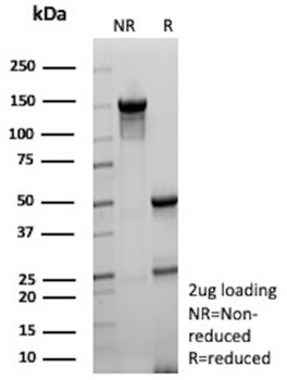 KLK4 Antibody