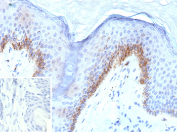 KLK4 Antibody