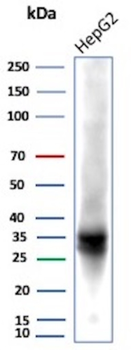 AKR1C1 Antibody