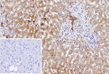 AKR1C1 Antibody